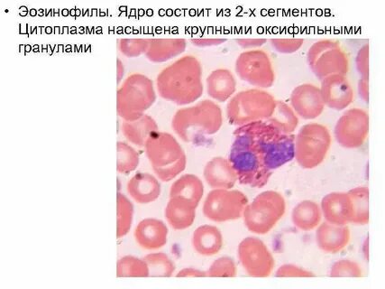 Эозинофилы абс что это такое