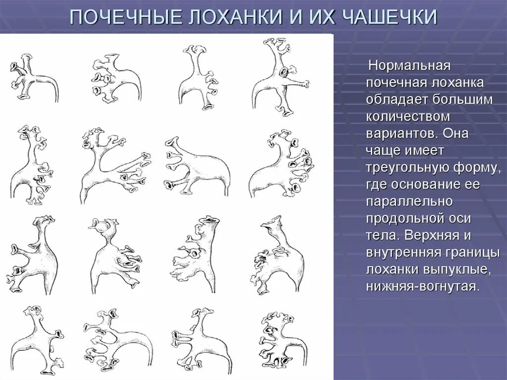 Варианты строения почечной лоханки. Варианты строения чашечно лоханочной системы. Типы строения почечных лоханок. Варианты почечных лоханок.