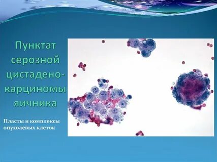 Макрофаги в молочной