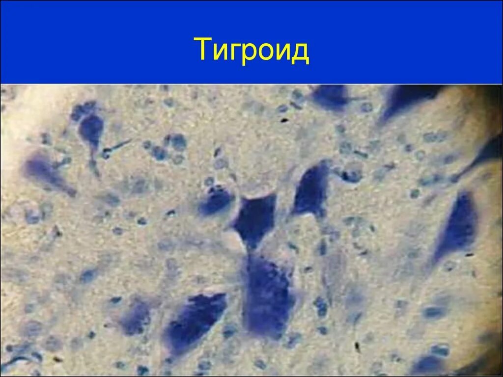 Тигроид гистология. Тельца ниссля гистология. тигроид в нервных клетках спинного мозга препарат. базофильное тигроидное вещество в нервных клетках спинного мозга. тигроид препарат гистология.