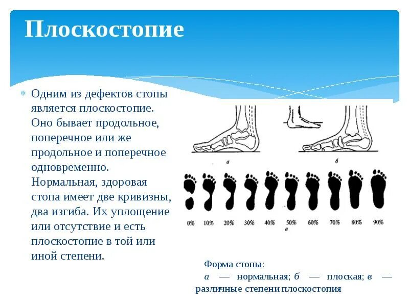 Поперечное 1 степени. Продольно-поперечное плоскостопие 2 степени. Продольным или поперечным плоскостопием II степени. Продольное плоскостопие 2-3 степени. Плоскостопие 1-2 степени.