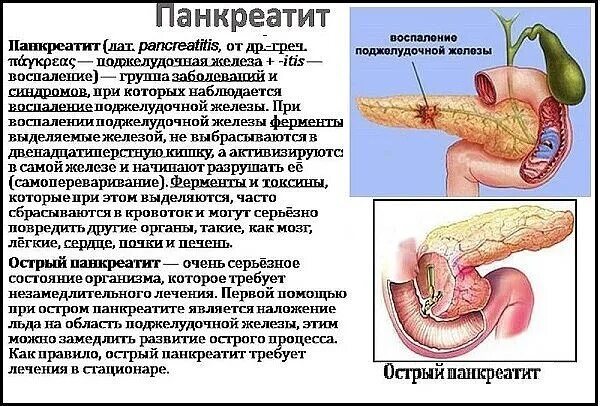 Могут ли быть запоры при панкреатите
