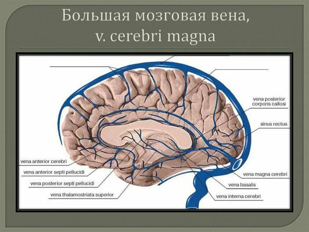 Вены головного мозга. Вена Галена головного мозга. Большая Вена мозга Вена Галена. Анатомия вены Галена. Вена Розенталя анатомия.