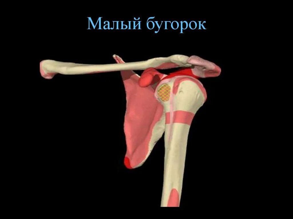 Уровень тольятти бугорок