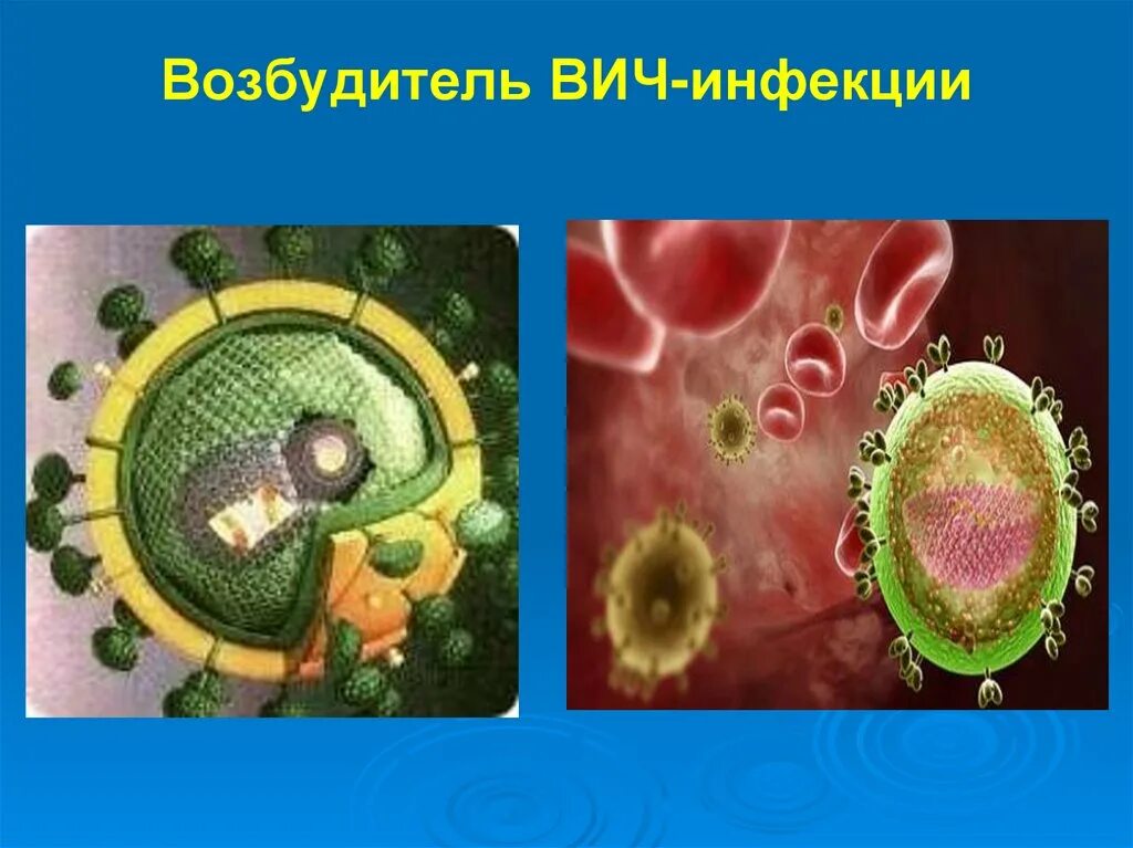 Возбудитель вич инфекции. Возбудитель иммунодефицита человека. Структура возбудителя вич инфекции. Возбудитель вич инфекции. Возбудитель иммунодефицита человека.