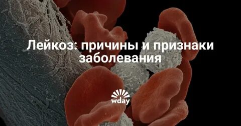 Причины лейкемии