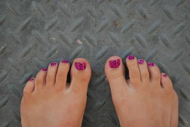 сводит мизинец на ноге