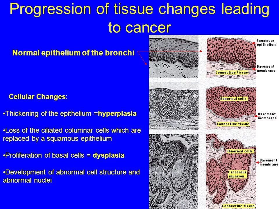 Changing cells