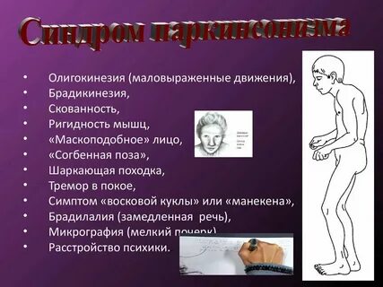 Скелетно мышечный синдром