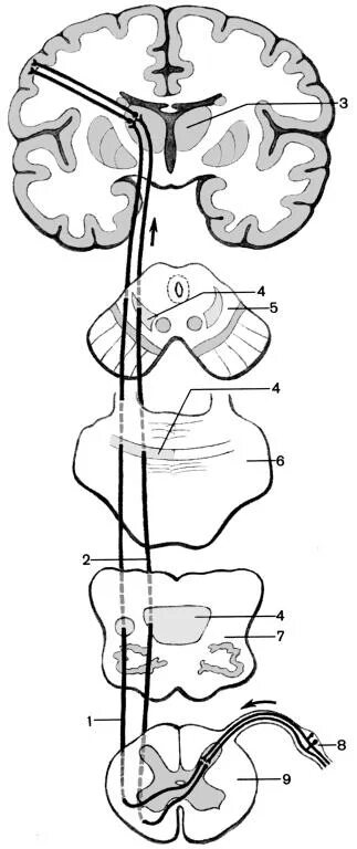 Спинно таламический. Передний спинно-таламический путь. Схема спинно-таламического пути. Передний спинно-таламический тракт. Латеральный спинно-таламический путь.