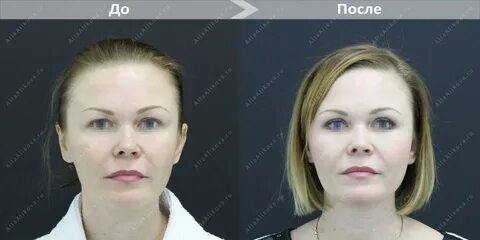 Пластическая хирургия в екатеринбурге московская