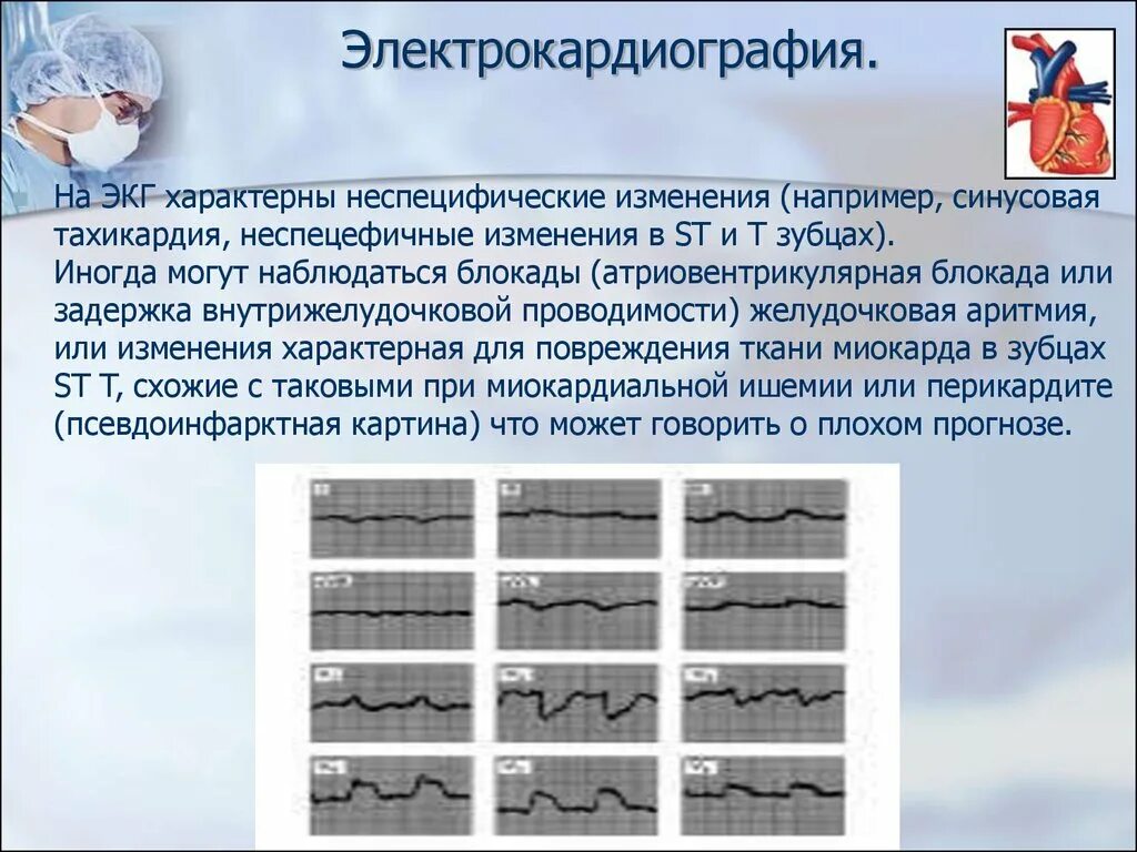 Умеренные неспецифические изменения