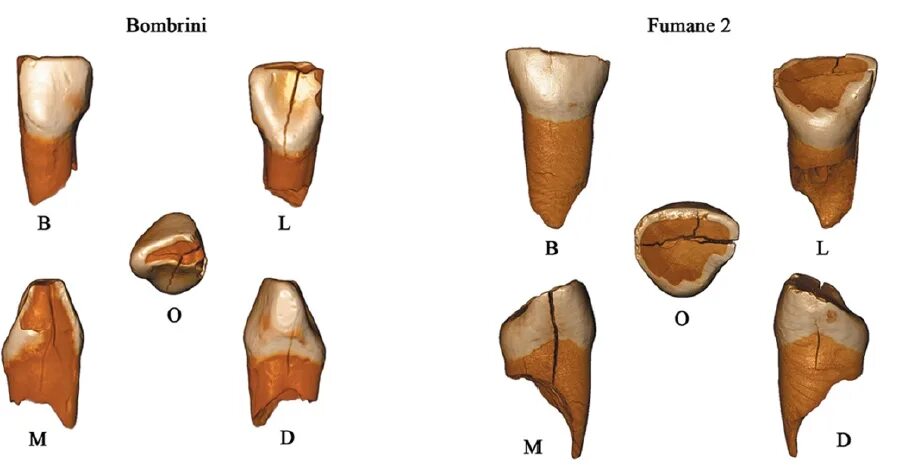 центральный молочный резец. центральный молочный резец. нижние резцы. центральный молочный резец. поверхности центрального резца верхней челюсти.