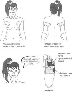 Можно ли клеить перцовый пластырь на поясницу