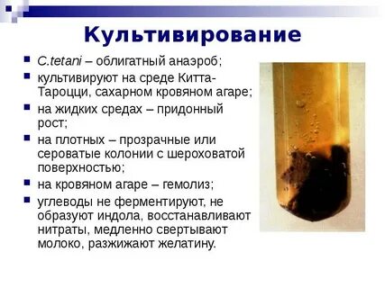 Китта тароцци