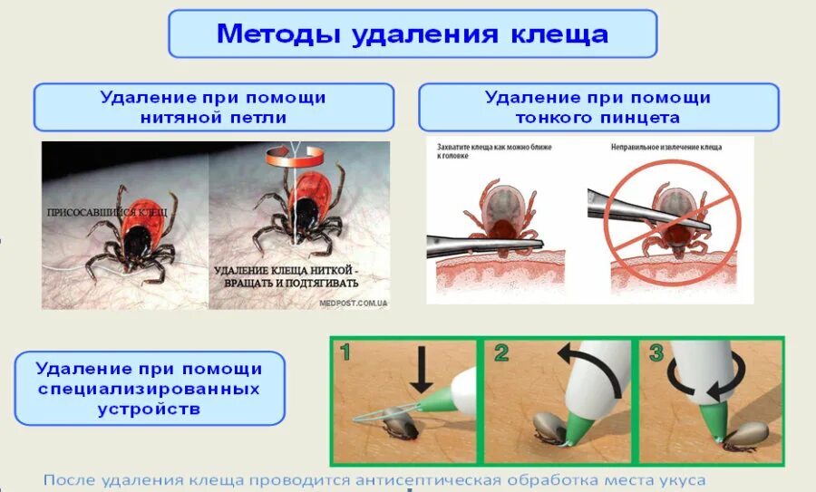 Как вытащить клеща у человека видео. Методика удаления клеща алгоритм. алгоритм удаления присосавшегося клеща. как удалить клеща самостоятельно.