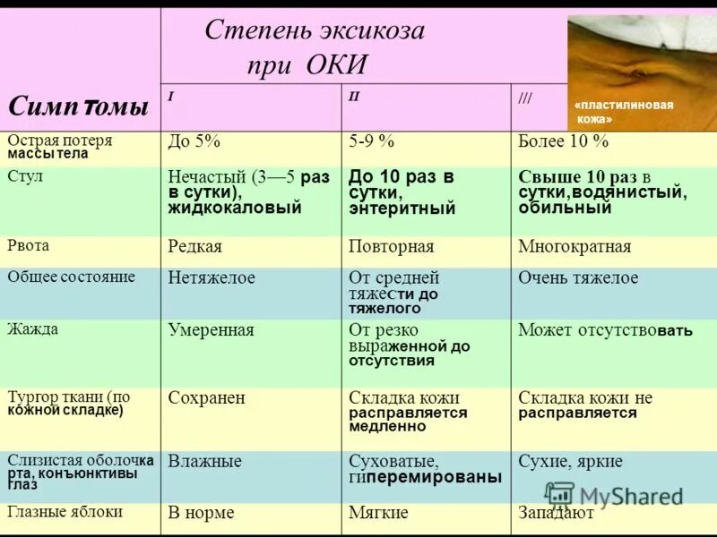 Обезвоживание у ребенка 3. Оценка степени тяжести эксикоза у детей. Оценка степени обезвоживания. Клиническая оценка тяжести эксикоза у детей. Критерии тяжести острых кишечных инфекций.