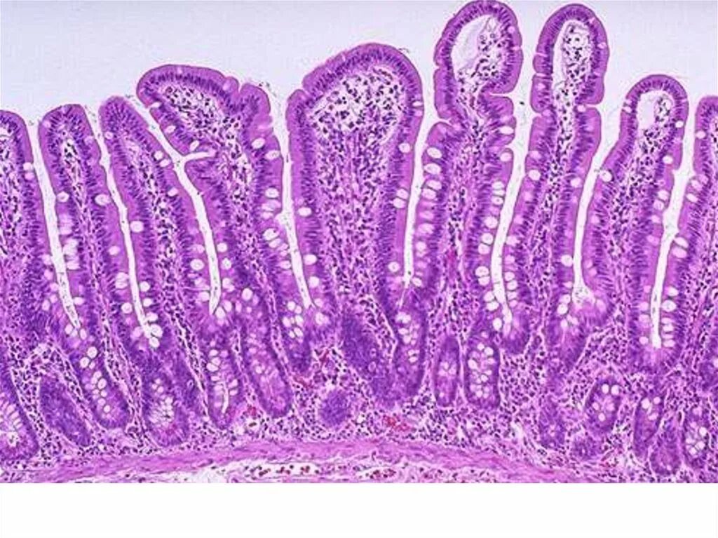 Ворсинки тонкой кишки гистология. Тонкая кишка гистология. Микроворсинки тонкого кишечника гистол. Эпителий тонкого кишечника гистология. Ткани тонкой кишки