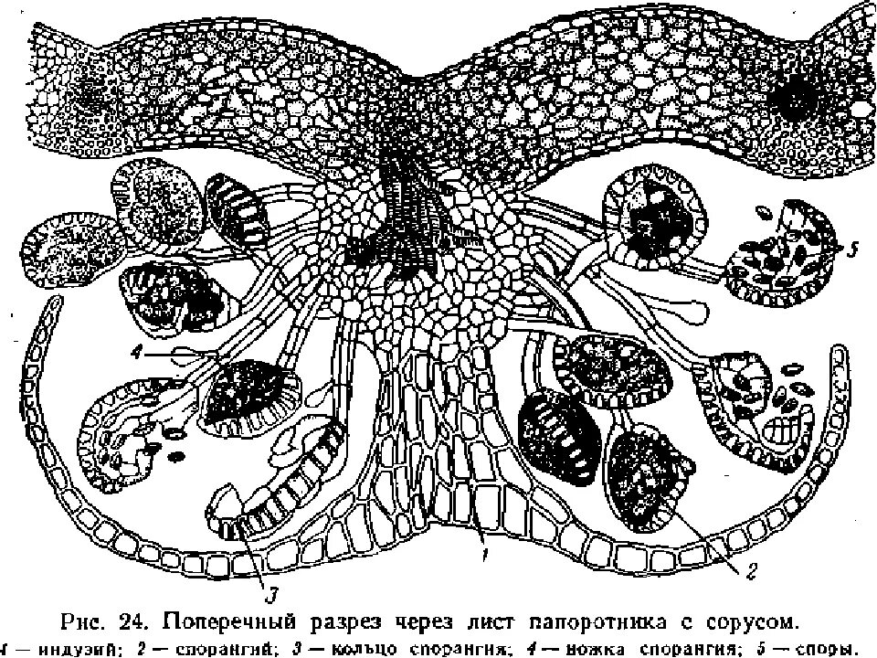 Сорус папоротника под микроскопом. Сорус папоротника под микроскопом. Сорус папоротника микропрепарат. Сорус папоротника микропрепарат. Зоруспапоротника под микроскопом.