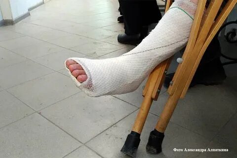 Девушка сломала ногу