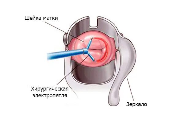 Как выглядит струп после прижигания Иллюстрации в искусстве: от идеи до реализации Мир на паузе