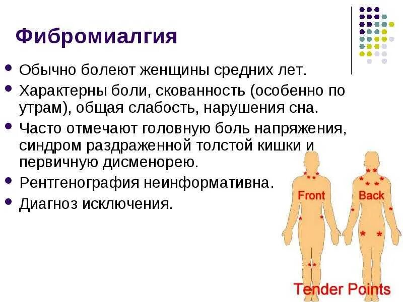 Фибромиалгия симптомы. Фибромиалгия. фибромиалгия симптомы причины. симптомы фибромиалгии у женщин. фибромиалгия симптомы диагностика.