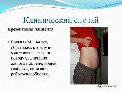 Увеличение случай