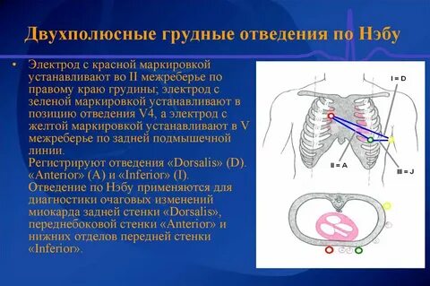 Правые отведения