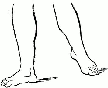 Leg color