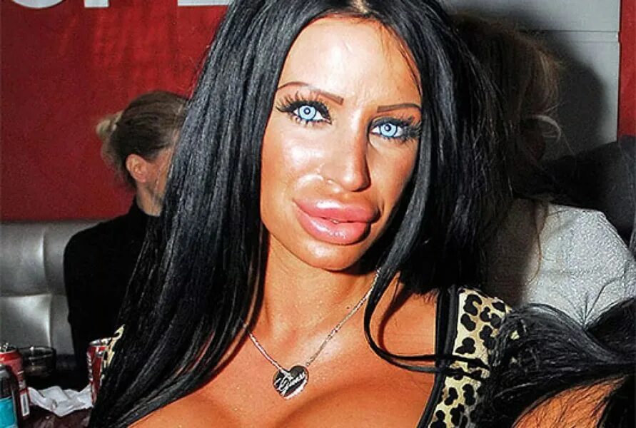 Красивые девушки с пирсингом. Большие жесткие губы. Губы накаченные гиалуроновой кислотой 1 мл. Большие жесткие губы. Большие жесткие губы.