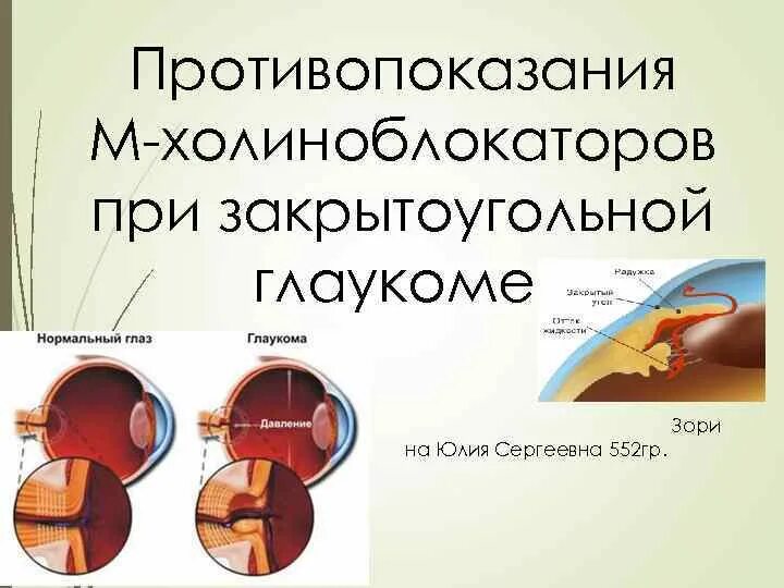 Препараты при закрытоугольной глаукоме. При глаукоме противопоказаны. Больным закрытоугольной глаукомой противопоказаны препараты. Препараты противопоказанные при глаукоме. При глаукоме можно применять