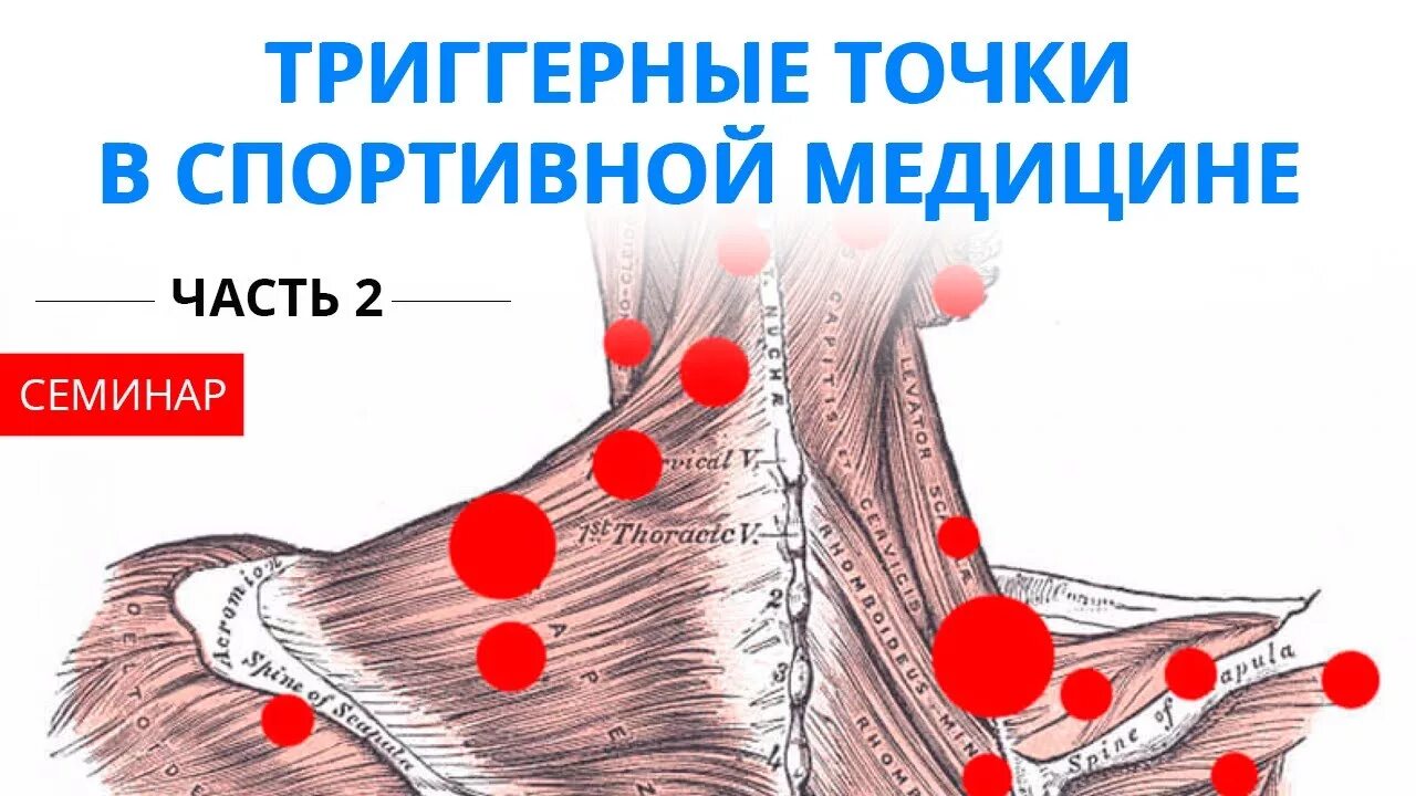 Как найти триггерную точку