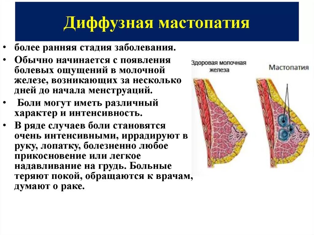Диффузная структура. Фиброзно-кистозная мастопатия. диффузная фиброзно-кистозная мастопатия. диффузная мастопатия молочных желез. фиброзно-кистозная мастопатия молочной железы.