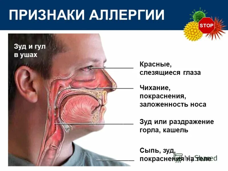 Почему не проходит заложенность