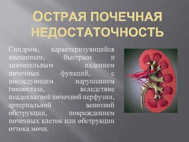 Острые почечные заболевания. Почечная недостаточность с4. Синдром острой почечной недостаточности (ОПН. Острая почечная недостаточность при ХБП. Аренальная почечная недостаточность.