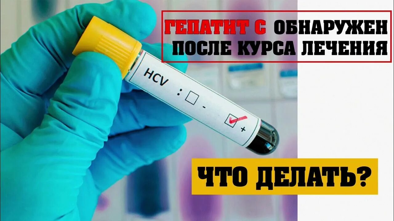 Вылечившись гепатит с отзывы. Гепатит ц. гепатит с лечится. как лечить гепатит.