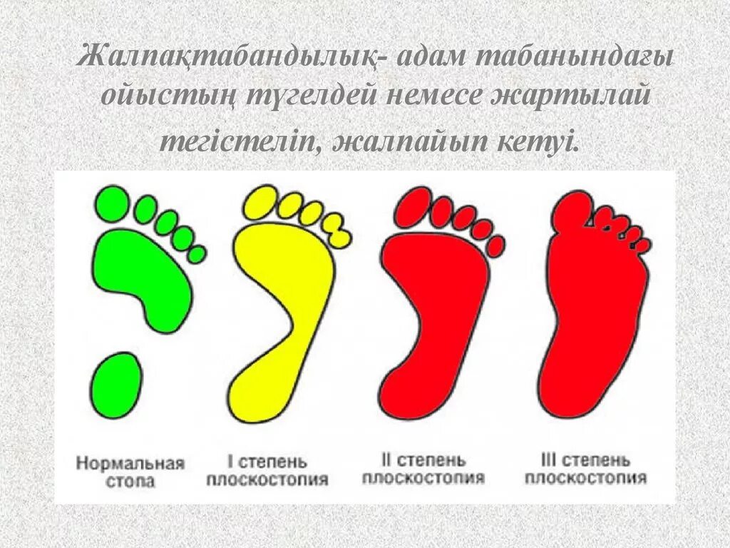 Плоскостопие как выглядит стопа. Отпечаток ноги с плоскостопием. стопа плоскостопие. оттиск стопы плоскостопия. отпечаток стопы с плоскостопием.