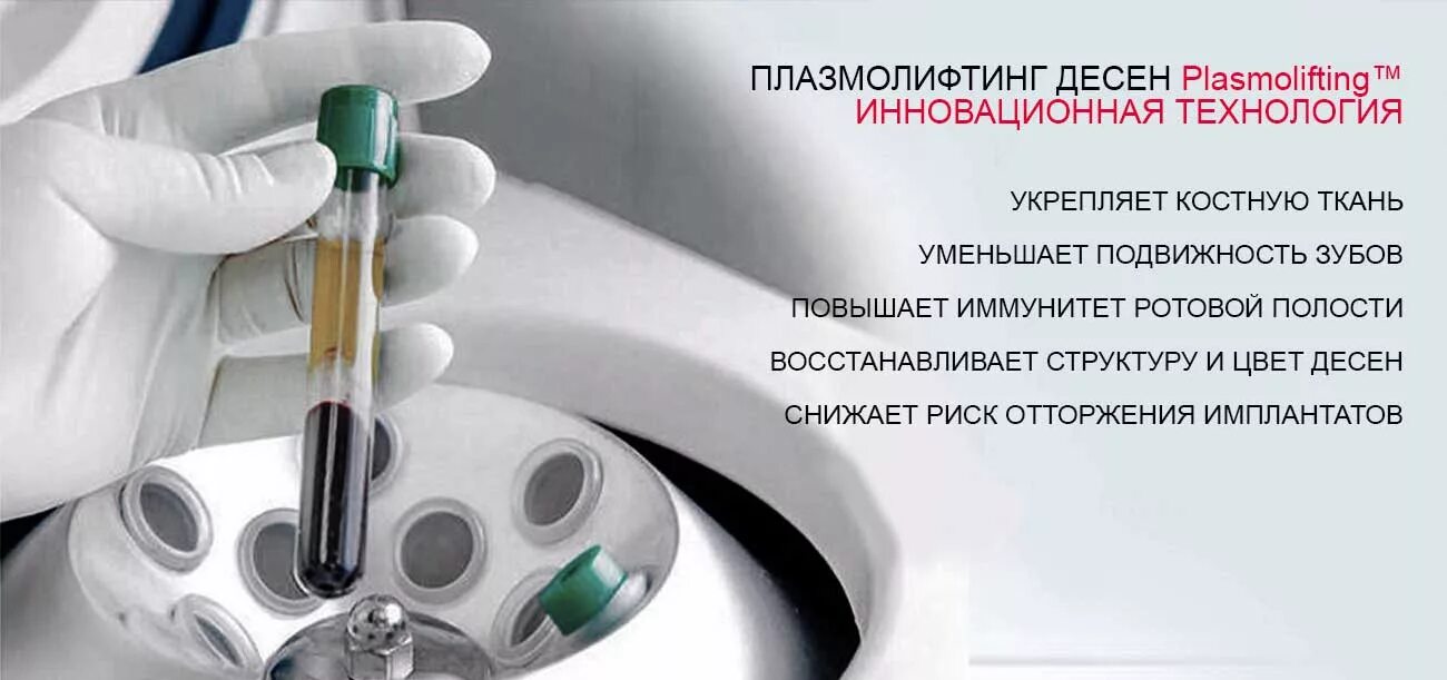 Плазмолифтинг в стоматологии. Плазмолифтинг стоматология десна. плазмолифтинг в стоматологии методика. плазматеропия для десе. плазмотерапия в стоматологии.