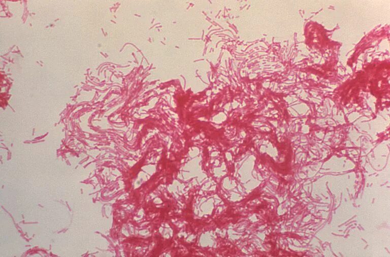 Haemophilus в мазке у мужчин. Стрептобацилла Дюкрея. Гемофильная палочка ducreyi.