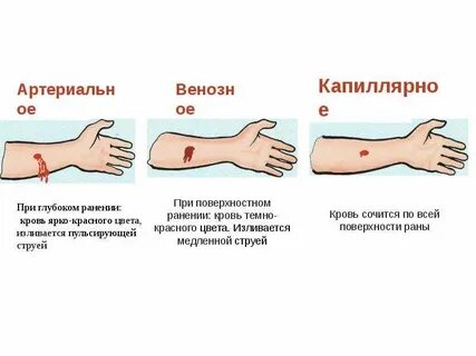 Причины кровотечения изо