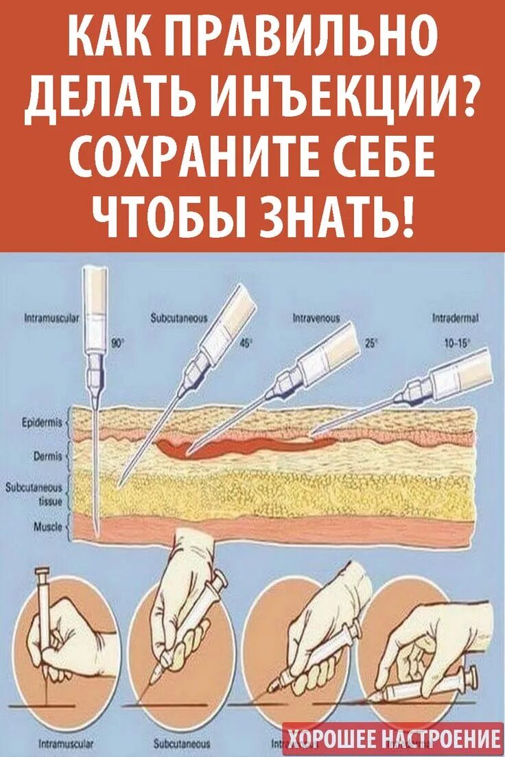 Подкожно угол введения иглы
