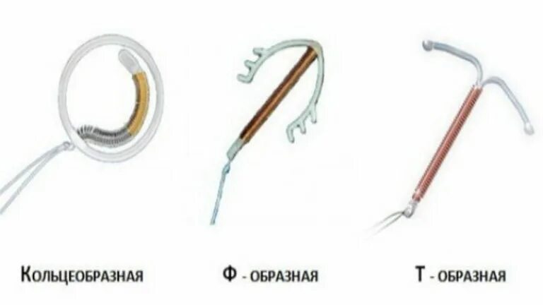 Когда ставить спираль до или после месячных. Внутриматочные противозачаточные спирали. внутриматочный контрацептив спираль. медьсодержащая внутриматочная спираль. спираль колечко внутриматочная.