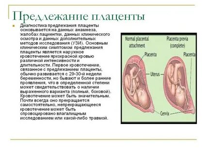 Беременность 12 недель низкая плацента
