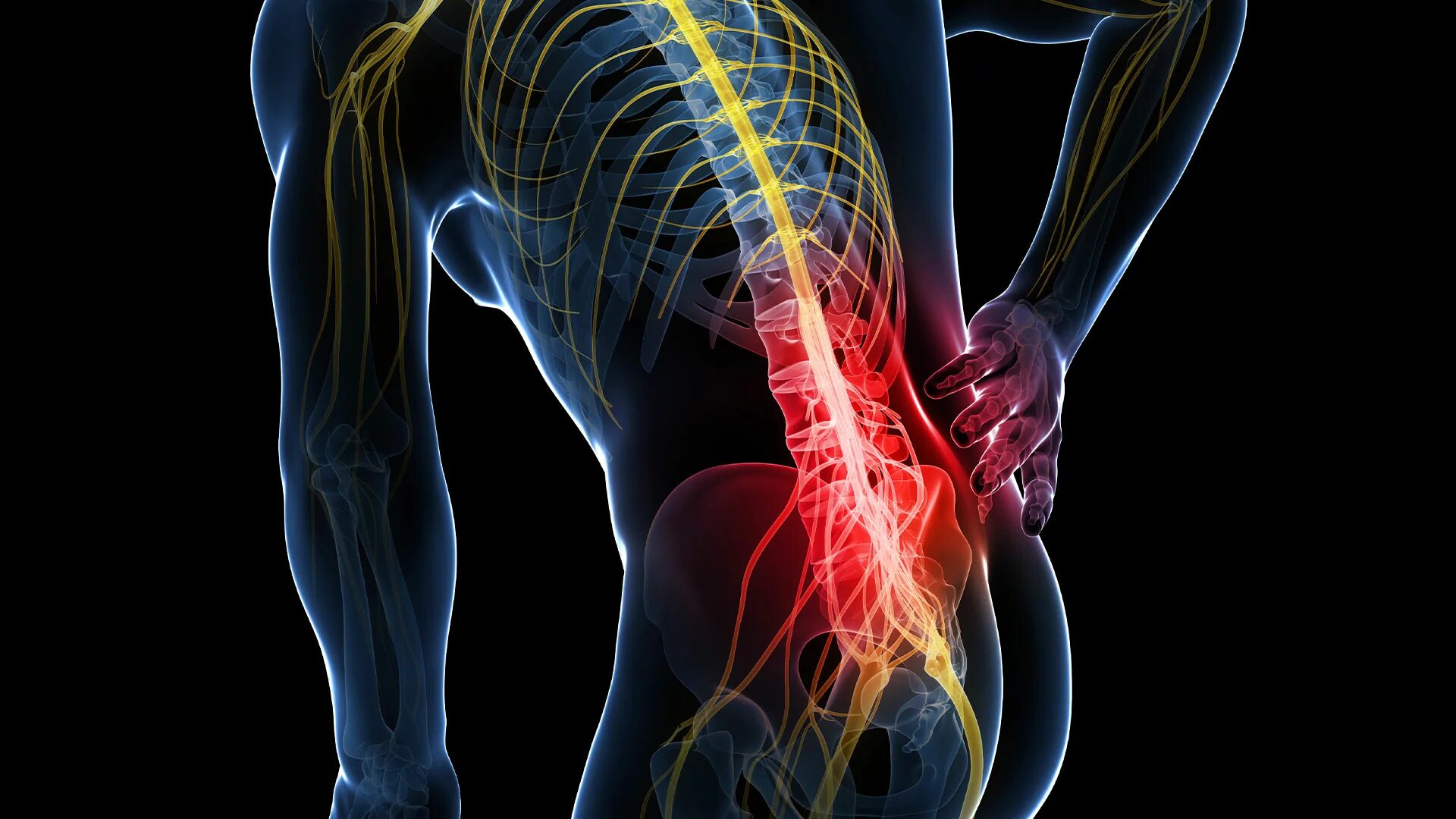 Болит нерв в пояснице. Седалищный нерв (sciatic nerve)? 011. плексит пояснично крестцового отдела. радикулит седалищный нерв в пояснице. воспаление седалищного нерва на рентгене.