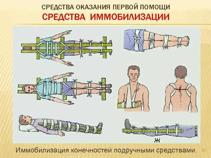 Подручные средства оказания 1 помощи. Иммобилизация конечности. Средства оказания первой помощи. Подручные средства оказания первой. Иммобилизация конечностей подручными средствами.