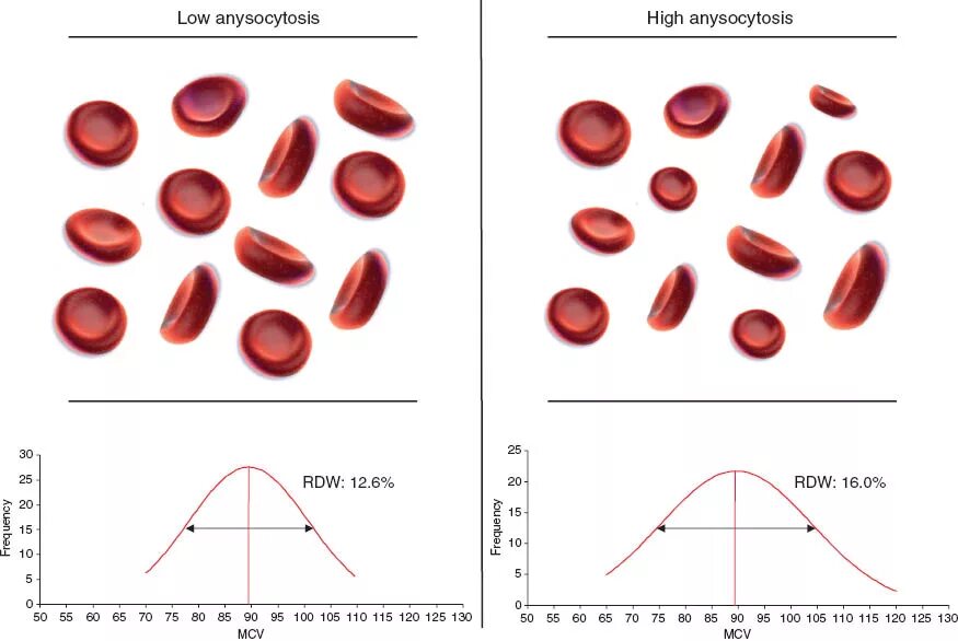 RDW (Red-Cell distribution width). RDW — Red Cell distribution. RDW (Red Cell distribution width) характеризует. MCH MCV RDW MCHC эритроциты.