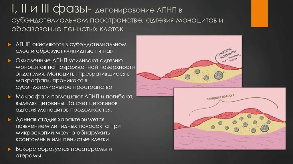 Пенистое содержимое. Суб эндотолиальный слой. Пенистые клетки. Пенистые клетки при атеросклерозе. Субэндотелиальный слой артерии.