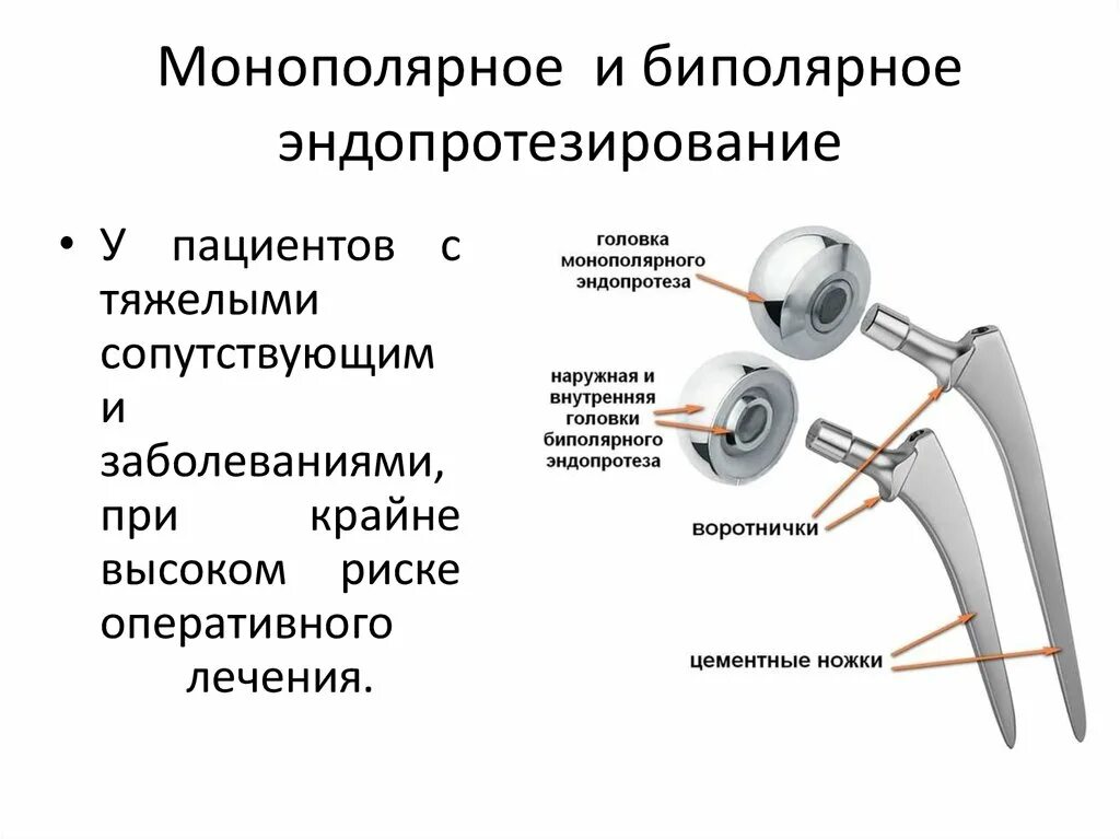 Однополюсные эндопротезы тазобедренного сустава. Эндопротезирование головки тазобедренного сустава. Эндопротез тазобедренного сустава кт. Однополюсный протез тазобедренного сустава. Замена т б сустава