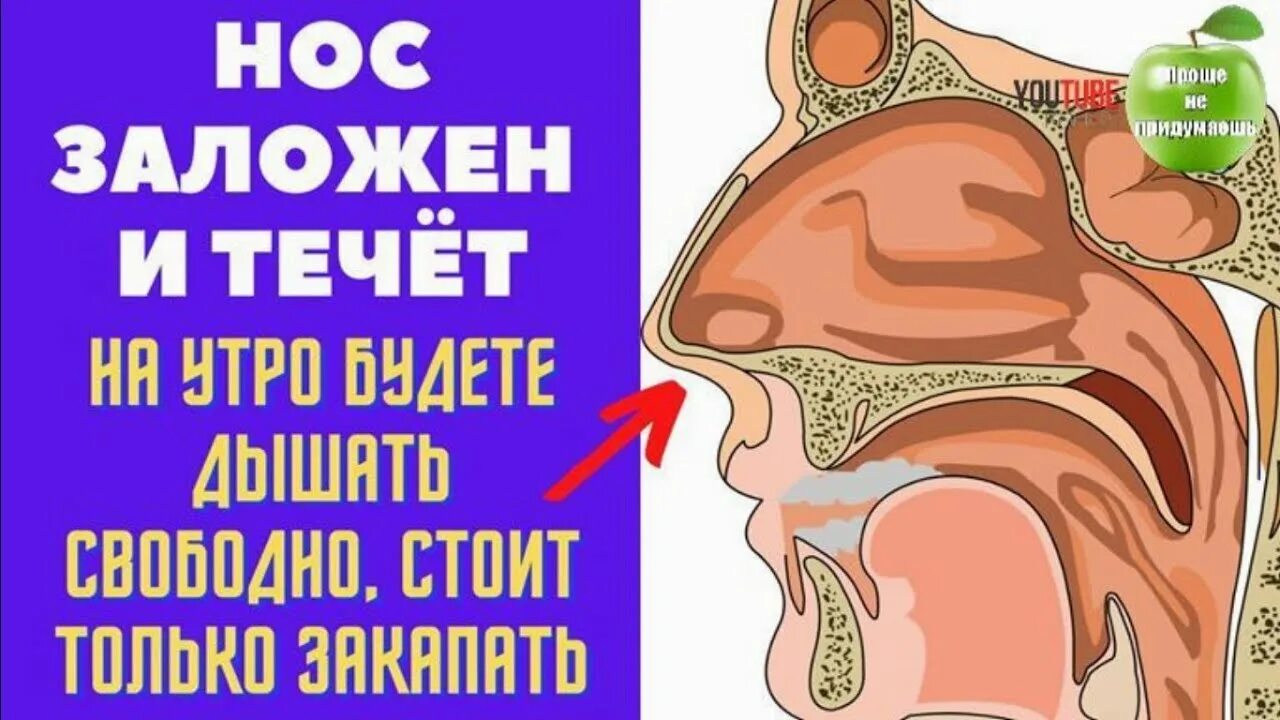 Почему течет нос при простуде. Почему закладывается нос.