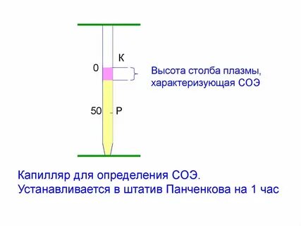 Скорость оседания эритроцитов по панченкову
